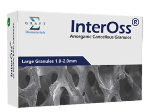 InterOss Anorganic Cancellous Granules (Type: Large and  2.0 g/8.0 cc and  )