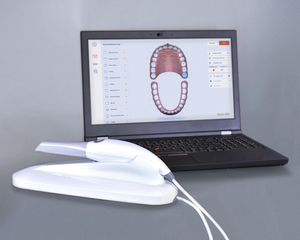 Intraoral Scanner ​3 DISC Heron