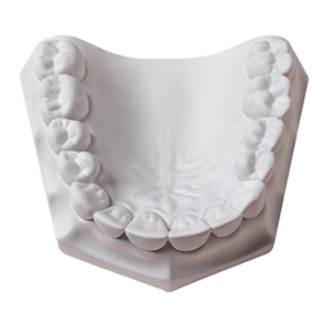 Orthodontic Plaster 33Lbs (Whipmix)